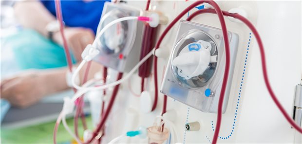 Die Universitäten in Mainz, Hannover und Berlin führen derzeit randomisierte Studien durch um die Wirksamkeit der Immunapherese als Therapieoption bei schwerem Post-Covid zu bewerten.