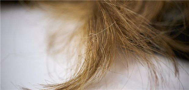 Frauen können wegen eines vorübergehenden Haarverlustes nach einer Chemotherapie regelmäßig keine Echthaarvollperücke auf Krankenkassenkosten verlangen. So entschied jetzt das das Schleswig-Holsteinische Landessozialgericht.
