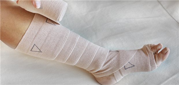 Für eine gute Wundheilung kann Kompressionstherapie bei Ulcus cruris essenziell sein.