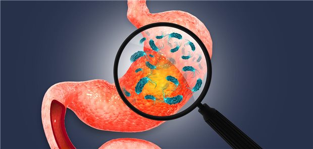 Studie: Routinemäßiges H. pylori-Screening nach Myokardinfarkt nicht zu empfehlen 3D-Illustration von H. pylori-Bakterien.