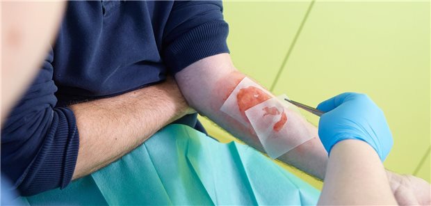 Hauptzweck „sonstiger Wundprodukte“.ist nicht die Verbandfunktion, sondern die therapeutische Wirkung auf den Wundverschluss.