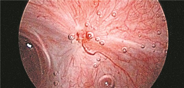 Schaubild des unteren Bauches einer Frau. 