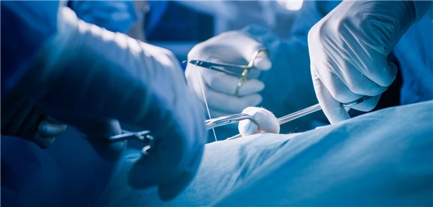 Welcher Knotentyp hält bei laparoskopischer Naht am besten? Nahaufnahme der Hände eines professionellen Chirurgen, der nach einer erfolgreichen Operation eine Wunde näht.