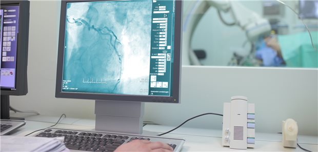 Herzkatheter ohne vorherigen Infarkt: Große regionale Unterschiede In Regionen mit vielen Herzkatheterlaboren werden bei Patienten ohne Myokardinfarkt signifikant häufiger Koronar-Angiografien vorgenommen als in Regionen mit weniger Katheterlaboren.