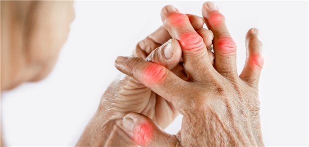 Eine Frau greift sich an ihre Fingergelenke.