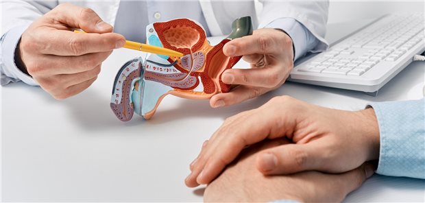 Anatomisches Modell des männlichen Fortpflanzungssystems in den Händen eines Arztes in Nahaufnahme während der Beratung eines männlichen Patienten mit Prostatakarzinom.