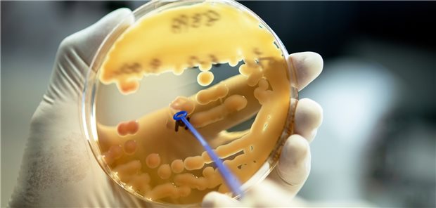 Klebsiella pneumoniae: Isolate des Bakteriums werden seit dem Frühjahr 2022 stark vermehrt in Proben aus deutschen Kliniken nachgewiesen.
