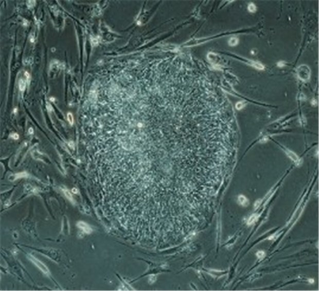 Alternative zu Embryozellen entwickelt Kolonie aus Zellen, die humanen Embryo-Stammzellen sehr ähneln. Sie entstanden durch Reprogrammierung von Hautzellen.