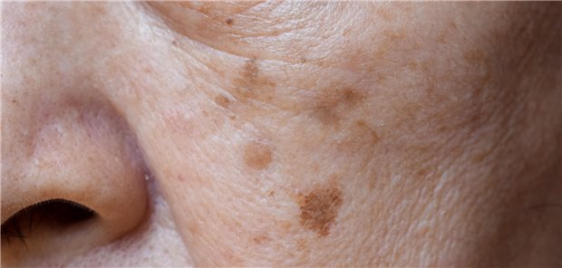 Longevity: Was wirklich hinter dem Trend steckt Länger leben um jeden Preis: Was ist wissenschaftlich bewiesen und können Medikamente hierbei helfen?