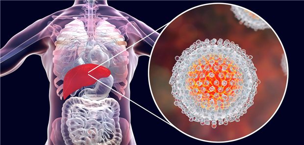 Hepatitis C: Direkt antiviral wirksame Substanzen senken wohl Risiko für extrahepatische Organschäde Laut Studien könnte die virale Replikation des Hepatitis-C-Virus im extrahepatischen Gewebe eine ausgeprägte Immunaktivierung mit systemischer Wirkung fördern und so zu Komplikationen auch außerhalb der Leber führen.