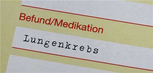 Lungenkrebs-Screening wird Kassenleistung Lungenkrebs so früh wie möglich erkennen und damit die Heilungschancen erhöhen helfen soll das neue Früherkennungsprogramm, das der G-BA beschlossen hat.
