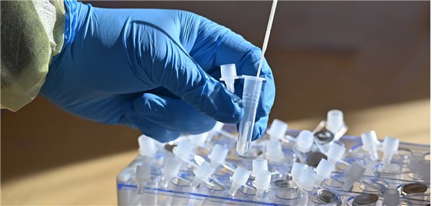 KBV-Chef Gassen gegen „massenhaftes, unkontrolliertes Testen“ Ein Teststaebchen wird nach einem Nasenabstrich in ein Roehrchen mit einer Testloesung,Fluessigkeit getaucht Corona Schnelltest auf die Omicron Variante.