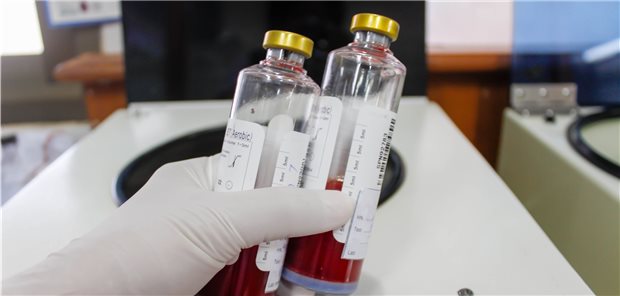 Mit Hilfe der Blutkultur wird versucht, die Erreger zu finden und zu identifizieren.