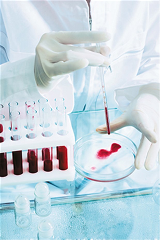 Was bedeutet personalisierte Medizin heute? Mit Labortests kann bei der personalisierten Medizin festgestellt werden, ob bestimmte Arzneien Wirkung versprechen.