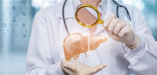 Leberkrebs: Screening nach ausgeheilter Hepatitis C bald personalisiert Ein Arzt hält eine Lupe in der Hand und richtet diese auf eine Darstellung der Leber.