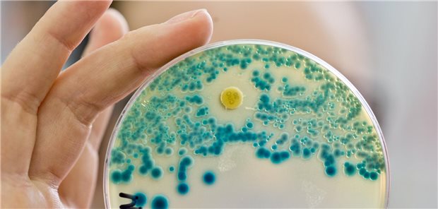 Leopoldina: Kluge Anreize für neue Antibiotika nötig Ein Bakterienkultur auf einer Petrischale