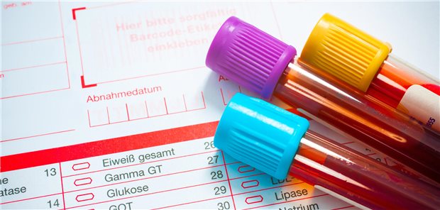 Nicht immer werden die Blutproben wie hier mit Auftrag ins Labor geschickt. In manchen Facharztpraxen ist die PoC-Diagnostik gang und gäbe.