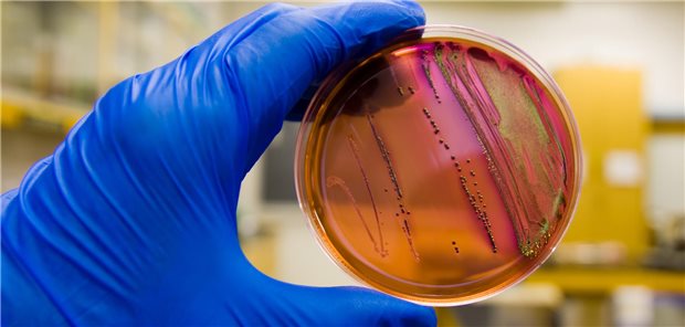 MRSA-Nachweis im Labor