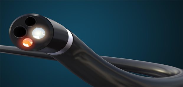 Darmkrebs-Screening: Es lohnt sich, genauer hinzusehen Perfekter Durchblick im Gastrointestinaltrakt: Die Inanspruchnahme der Früherkennungskoloskopien ist laut Zentralinstitut in den beiden vergangenen Jahren wieder gestiegen.