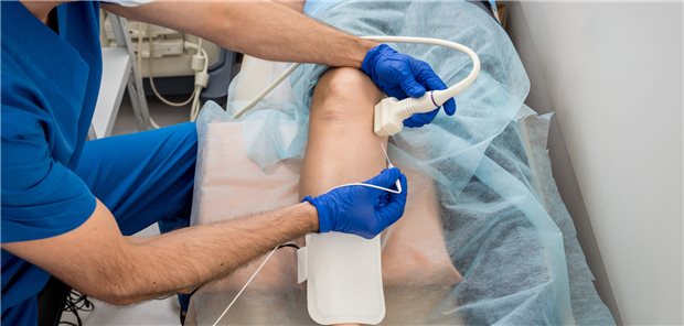 Perkutane Koronarintervention (PCI): Das optimale „Timing“ bei kompletter Revaskularisation ist unklar, jetzt gibt es dazu interessante Ergebnisse aus einer Studie.
