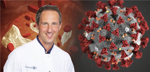 Warum die Thromboseprophylaxe bei COVID-19-Patienten eine wichtige Rolle im Therapiemanagement spiel Prof. Dr. Florian Langer, Facharzt für Innere Medizin und Facharzt für Hämatologie – Internistische Onkologie am Universitätsklinikum Hamburg-Eppendorf