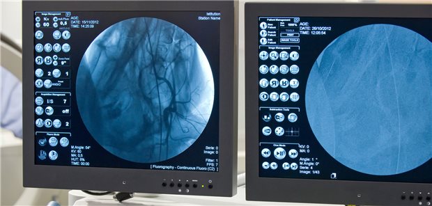 Serienangiografie ist ausschließlich Radiologen vorbehalten. Ärzte müssen die entsprechende Gebietsbezeichnung nachweisen.
