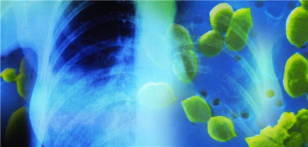 Sie sind die häufigsten Erreger ambulant erworbener Lungenentzündungen: Pneumokokken (grün).