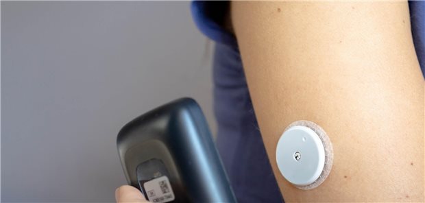 Systeme zur kontinuierlichen Glukosemessung sind zwar hoch akzeptiert, aber komplett verzichten kann man auf die HbA1c-Messung (noch) nicht.