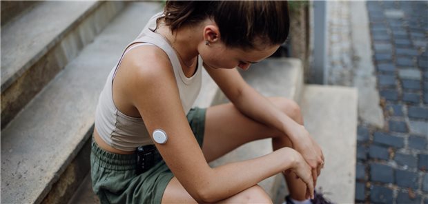 Frau mit Diabetes mit automatisiertem Insulindosierungs(AID)-System, der nach dem Lauftraining in der Stadt schwindelig ist