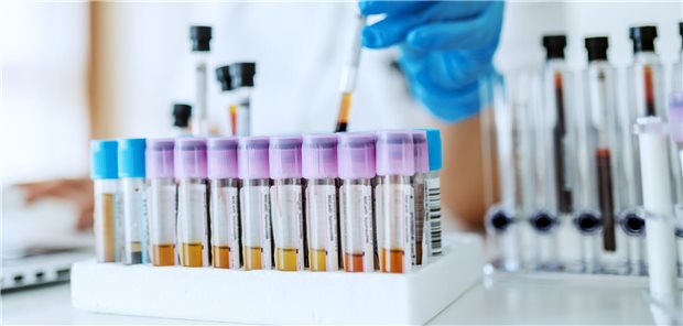 Im Labor werden Bluttests durchgeführt.