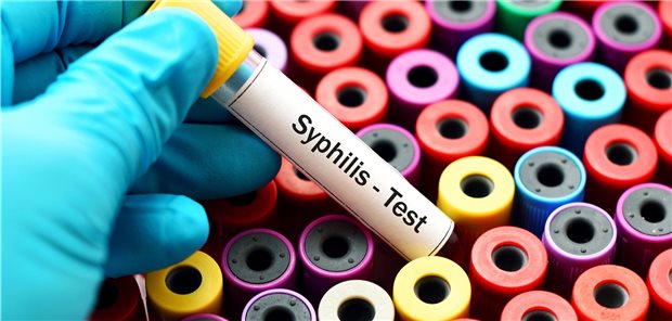 Test auf Syphilis: Für das Jahr 2019 berichtet das RKI von 7889 Infektionen.