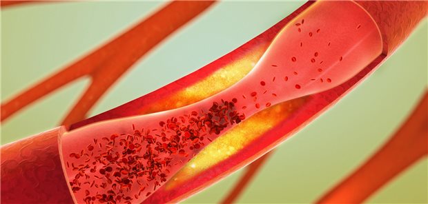 Eine Ärztin hält vor Publikum auf einem Podium eine Rede auf einem Kongress.