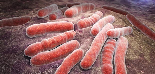 Europa verfehlt Teilziele im Kampf gegen HIV und Hepatitis Ein Tuberkulose-Erreger