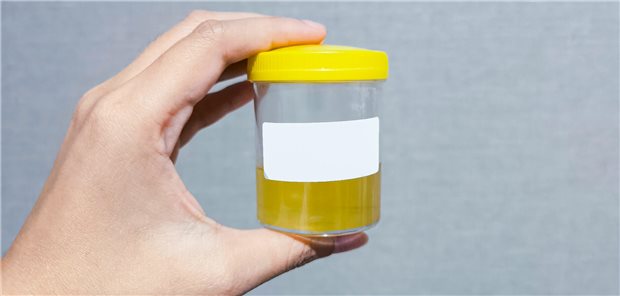 Innovationsausschuss hält drei Studien für transferwürdig Unkomplizierte Harnwegsinfekte führen oft zu Antibiotikaverordnungen. Wie diese verringert werden können, erprobte ein Innovationsfondsprojekt.