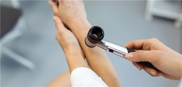 Eine Dermatologin bei der Hautuntersuchung mit einem Dermatoskop.