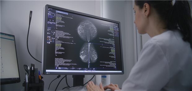 Brustkrebs-Studie: KI könnte jedes dritte Intervallkarzinom verhindern Eine Ärztin untersucht die Ergebnisse einer Mammographie-Untersuchung am Computer.