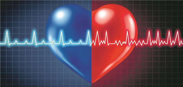 Vorhofflimmern im 1-Kanal-EKG