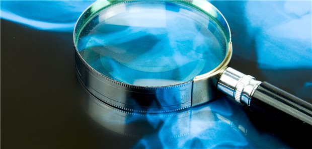 Schwangerschaftskomplikationen bei axialer Spondyloarthritis rückläufig WIrbelsäule im Fokus: Bei axialer Spondyloarthritis gibt es ja ein erhöhtes Risiko für Schwangerschaftskomplikationen, das Risiko dafür hat jedoch in den letzten Jahren abgenommen.