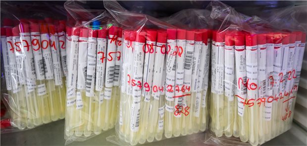 Keine Priorisierung von PCR-Tests in neuer Corona-Testverordnung PCR-Tests von Patienten liegen im Labor in einem Kühlschrank.