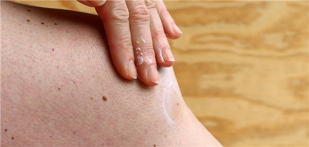 Eine Frau reibt ihr Knie mit einer Schmerzsalbe ein.