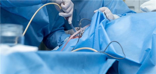 Leichte OSA, kleine Tonsillen: Mandelentfernung kann warten Ein HNO-Arzt führt eine Adenotonsillektomie (Entfernung der Mandeln) in einer sterilen Operationsumgebung durch.